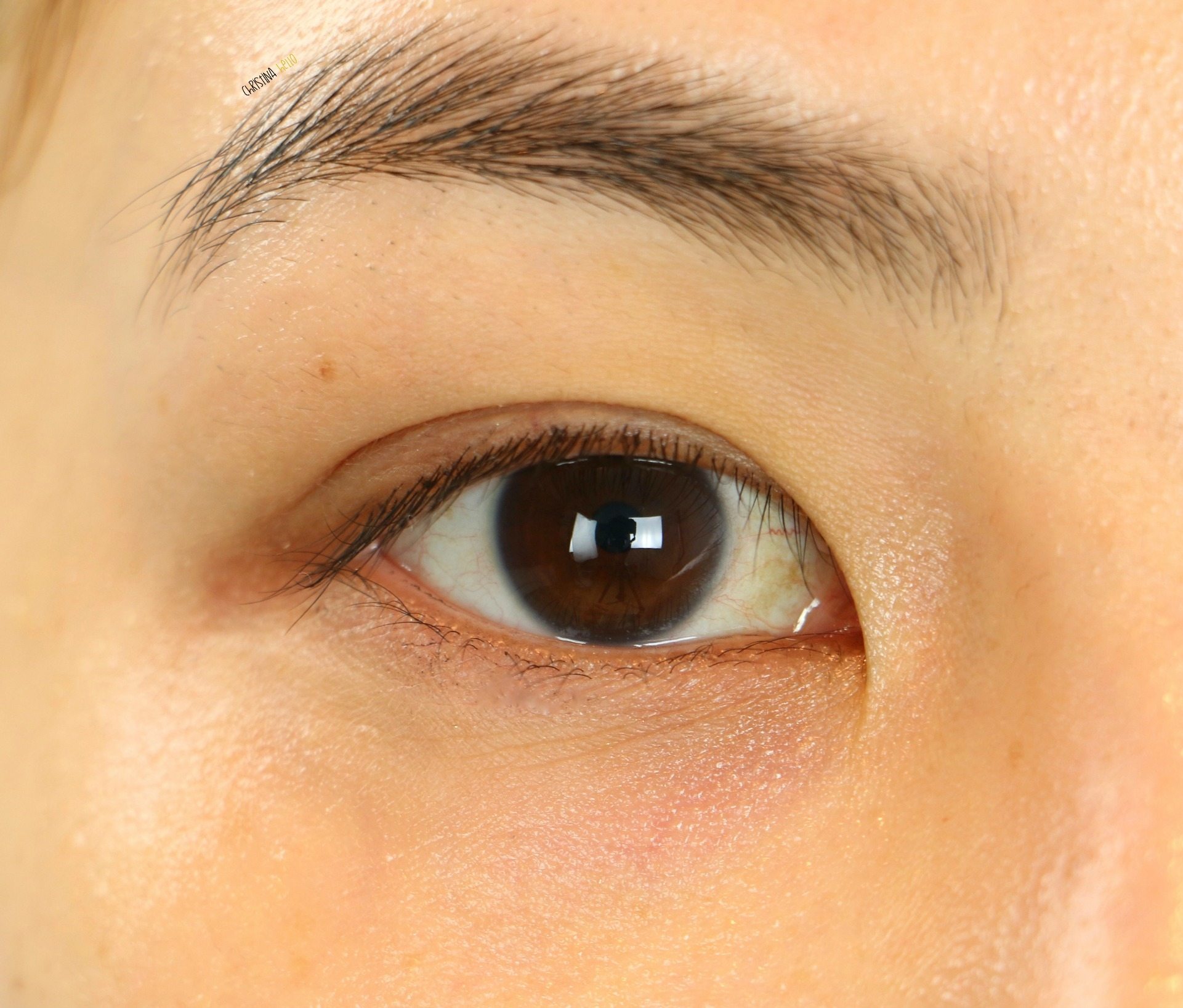 i have fine lines under my eyes